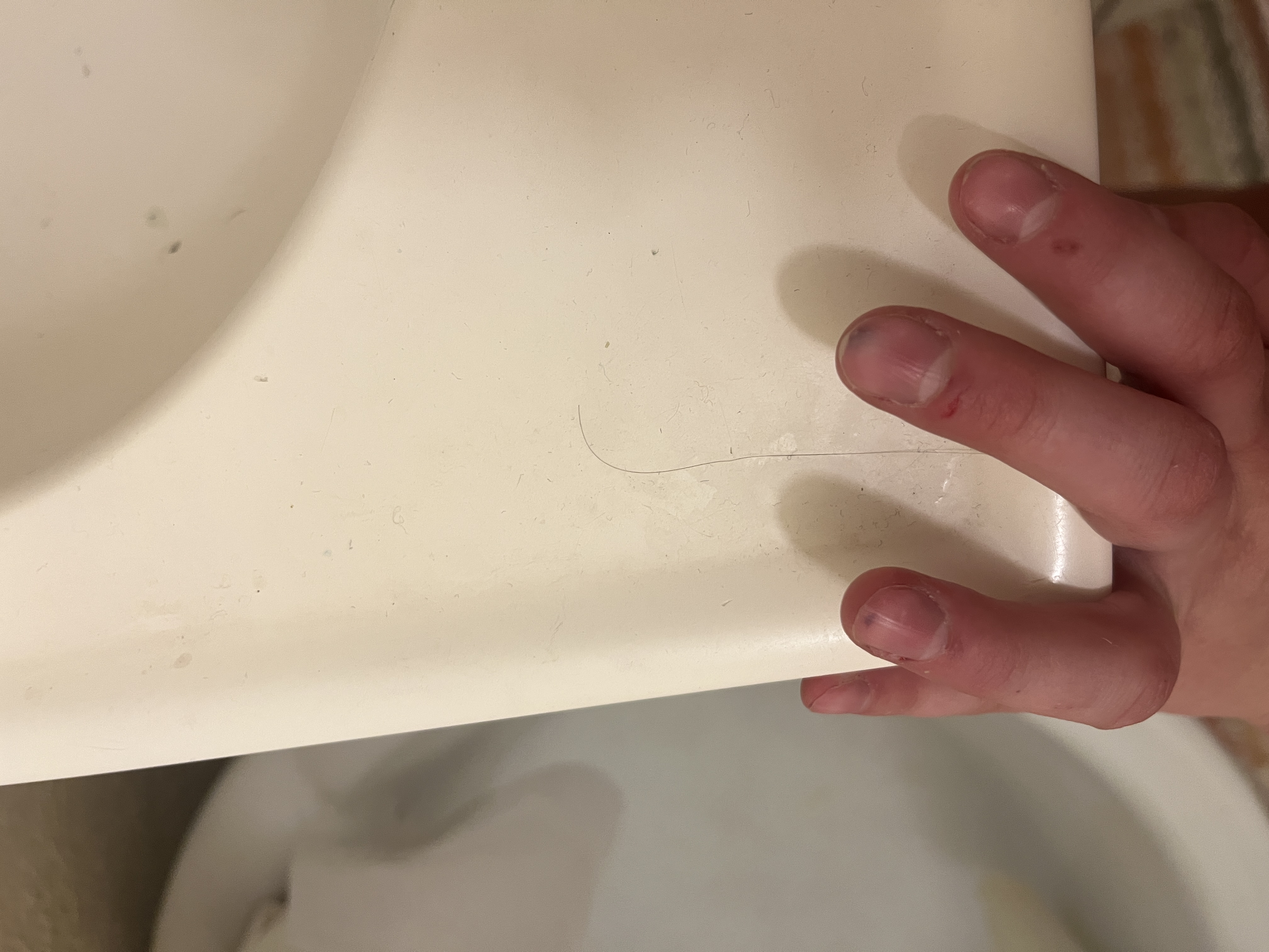 Workshop injury